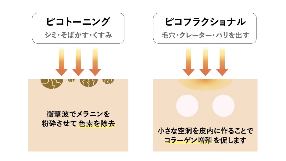 ピコダブルって？