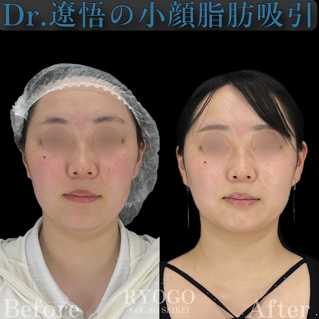 症例写真①【別人級に垢抜け】