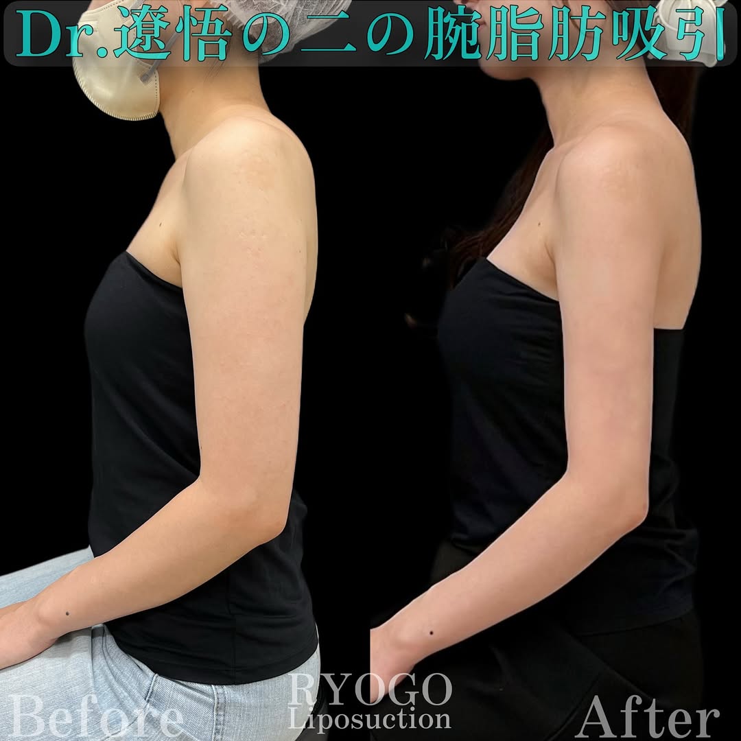 症例写真②【花嫁美容、一生に一度の晴れ舞台に向けて】