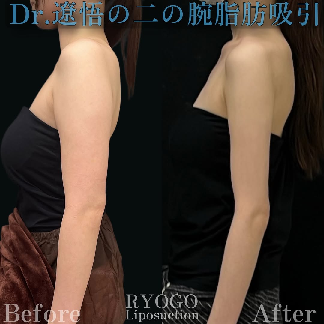 症例写真①【限りなくカリカリに】