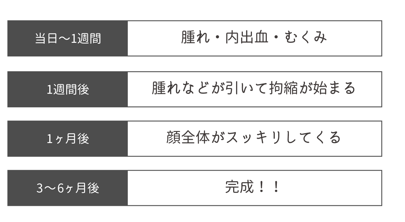 ダウンタイム