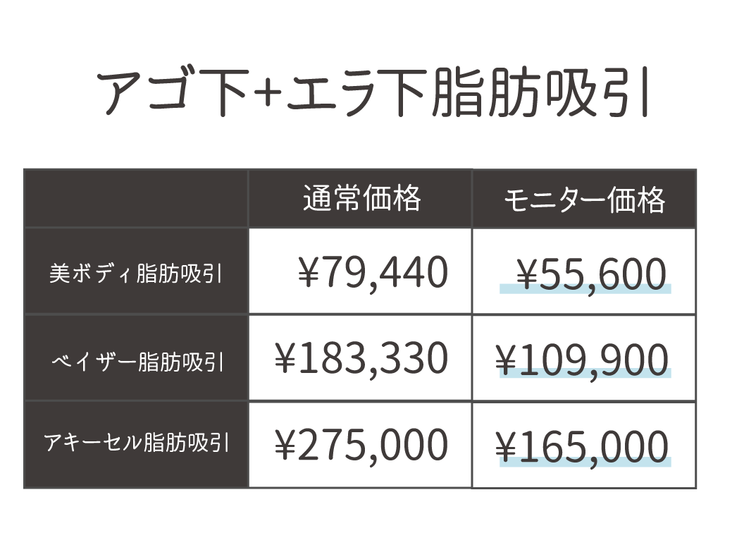 料金はどのくらい?