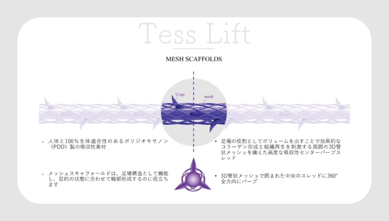 どんな所がメリット？