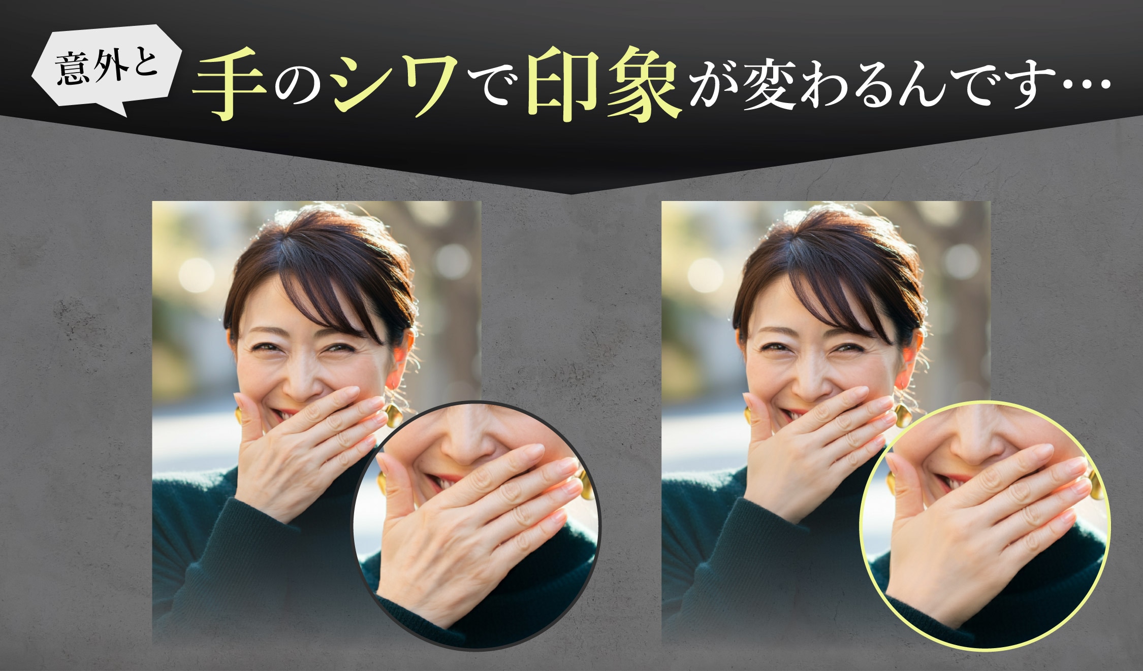 意外と手のシワで印象が変わるんです…【体の若返り★プロファイロボディ】