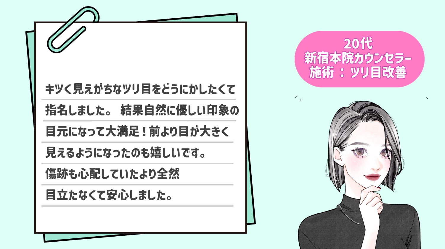 20代カウンセラー・ツリ目改善(下眼瞼下制)で指名しました