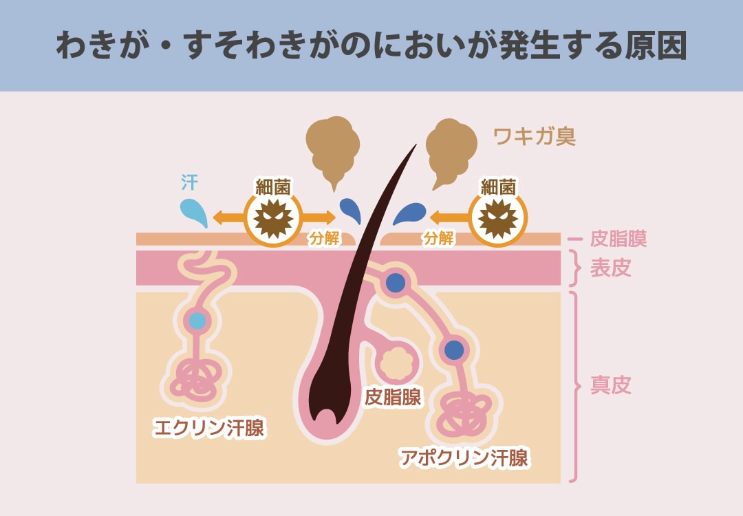 「すそわきが」とは