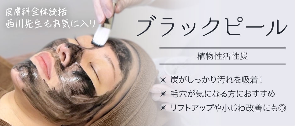 ブラックピール