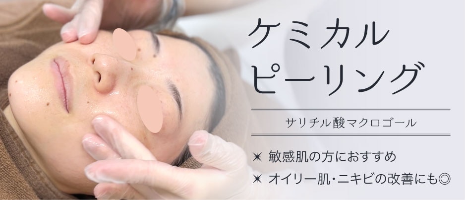 ケミカルピーリング(サリチル酸マクロゴール)【ニキビ肌・オイリー肌】