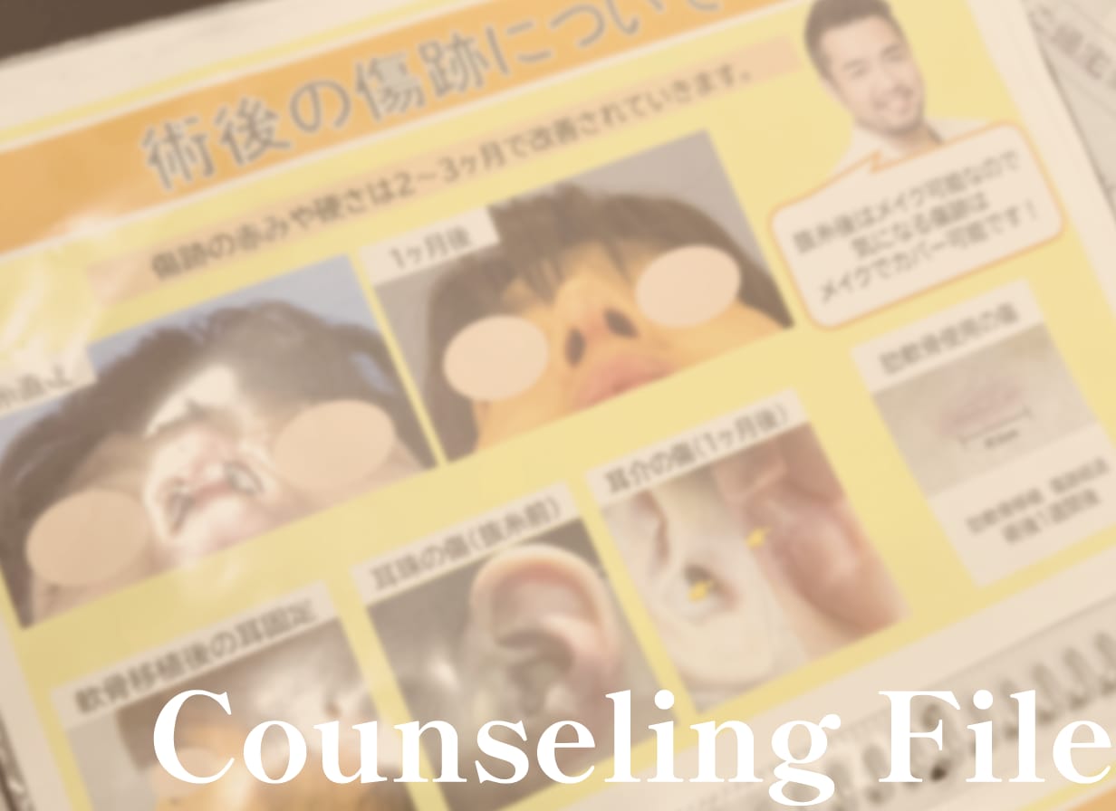 ここでしか見れない！ダウンタイムや傷口も載っているカウンセリングファイル