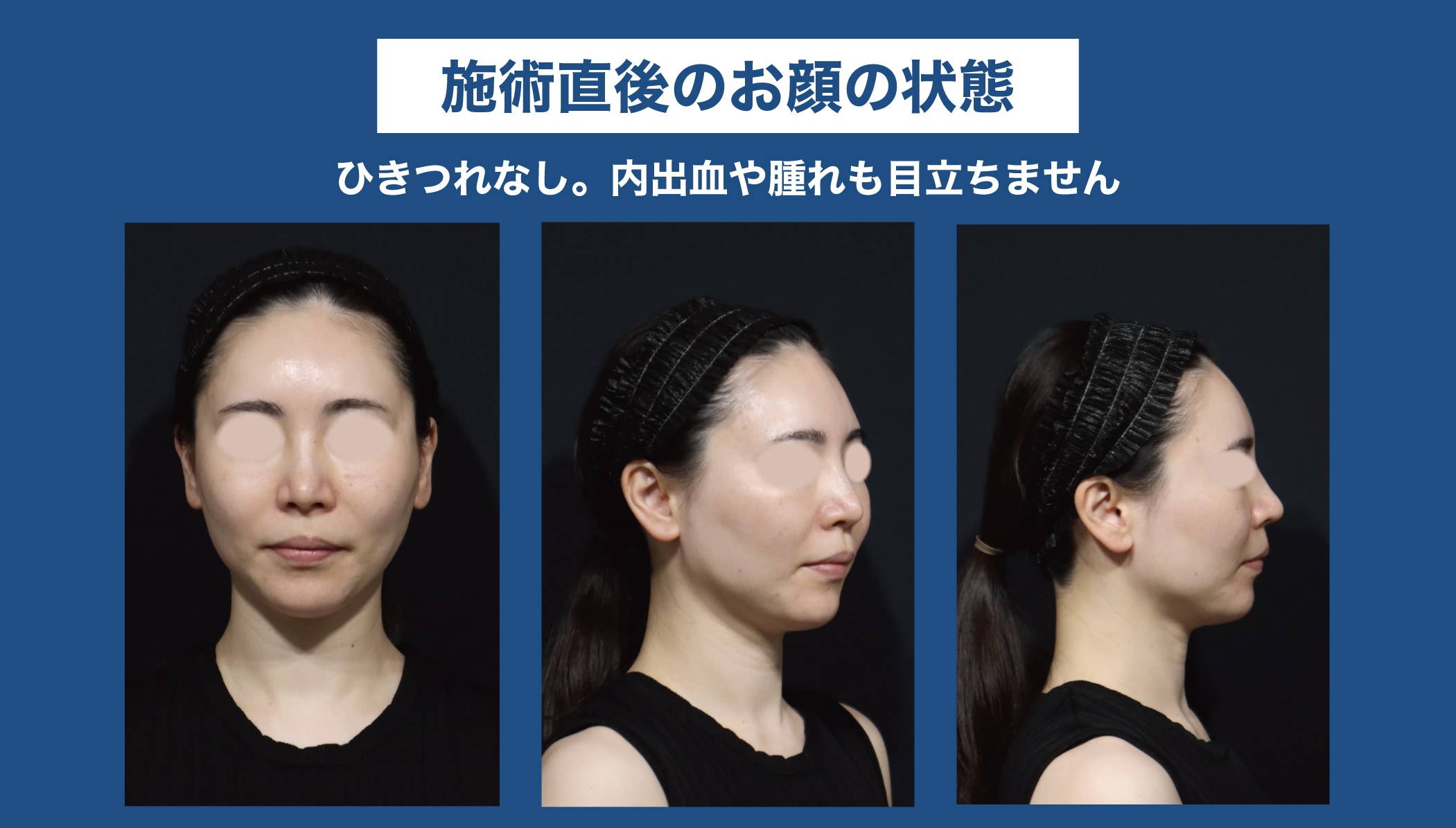 ◼️直後～当日の夜◼️