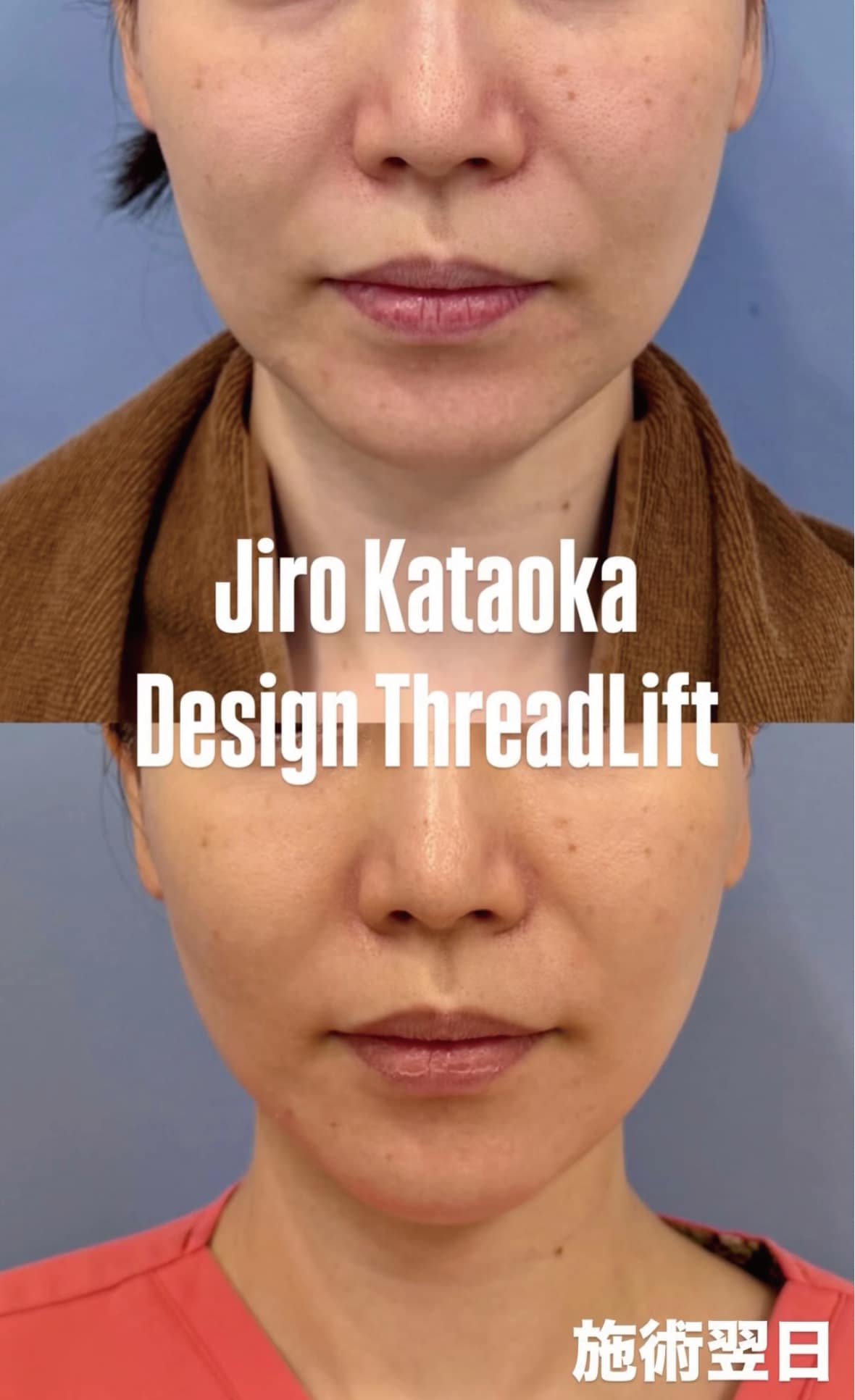 ◼️施術後1~2日目◼️