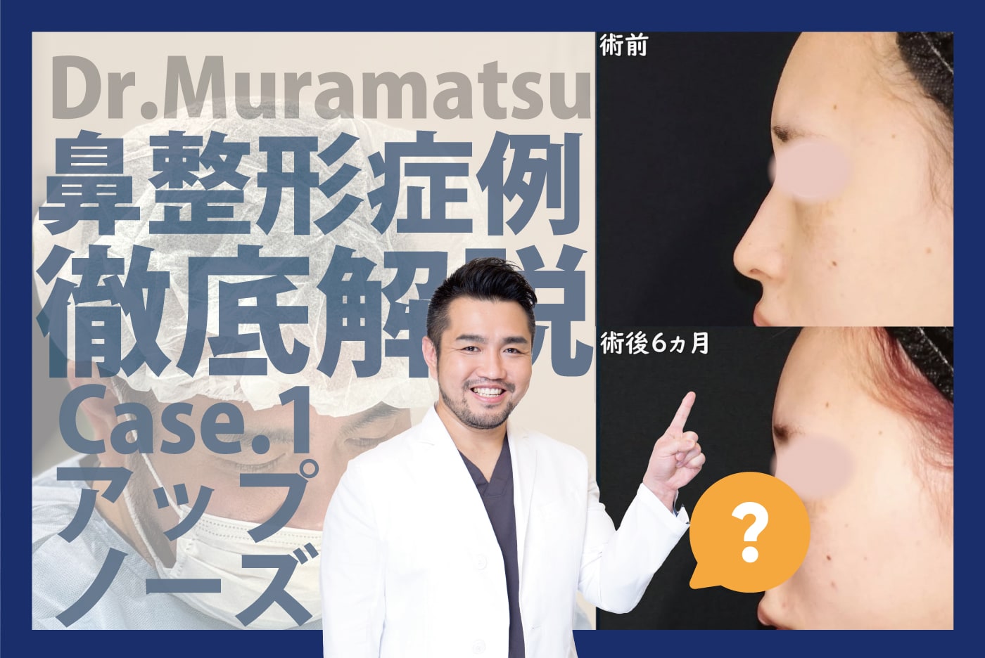 鼻の巧】新宿本院 村松先生の鼻整形ビフォーアフター徹底解説！【忘れ 