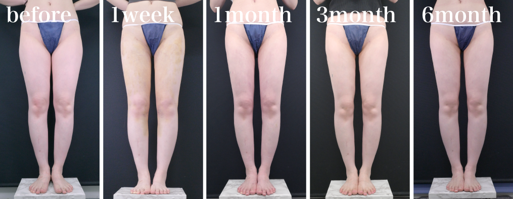 完成：3〜6か月