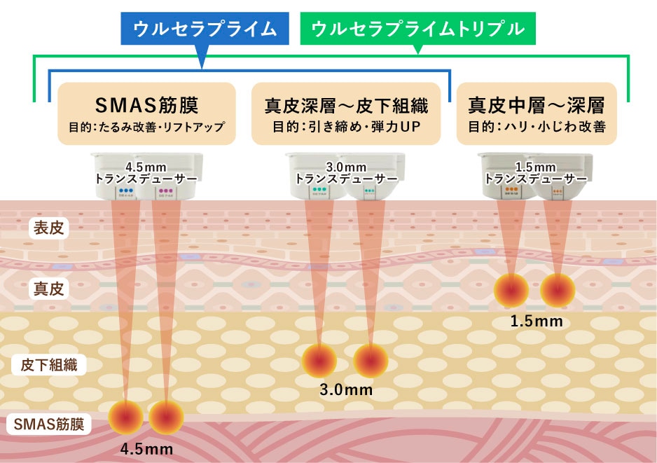 お悩みに合わせて選べます！