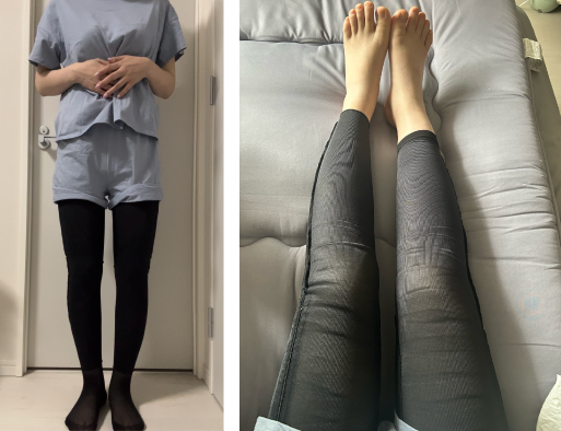 脂肪吸引後は、一定期間「圧迫着」の着用が必要