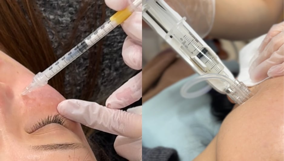 手打ち？機械打ち？