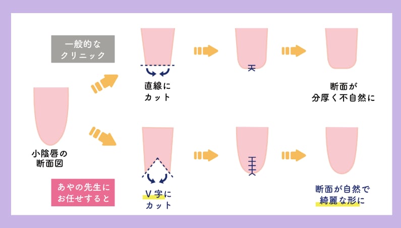 〜微調整をしながら理想に近づける〜
