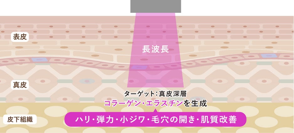 「長波長」が鍵！