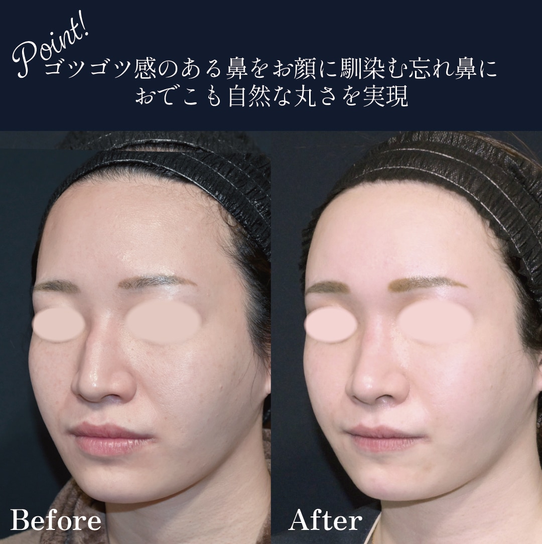 斜めからの比較写真：ゴツゴツ感を無くして柔らかい印象を作り出す