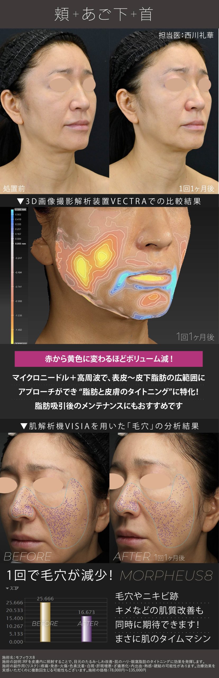 頬＋あご下＋首