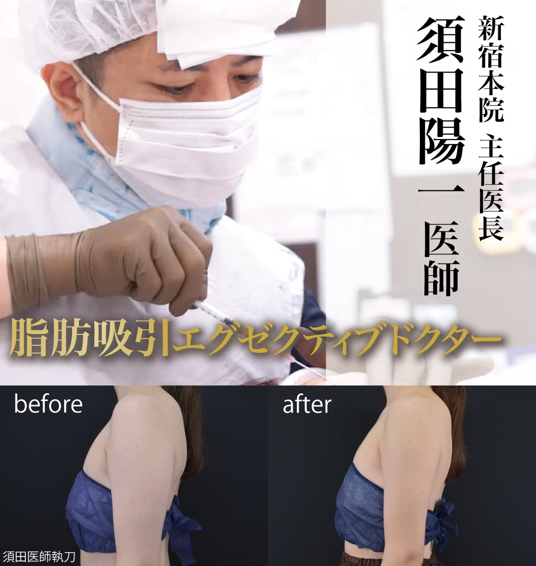 美しい二の腕を作る「技術力」と「独自の黄金比デザイン」