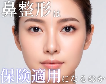 鼻整形は保険適用できる?美容クリニックの視点で解説