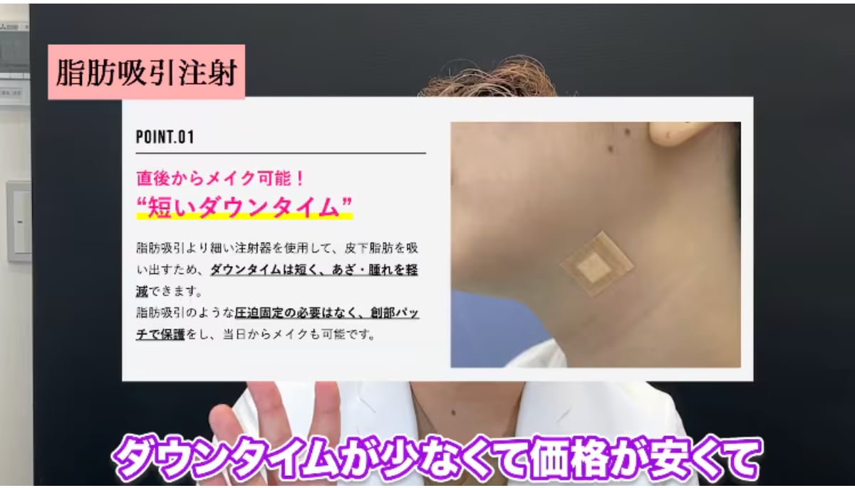 脂肪吸引注射のメリット