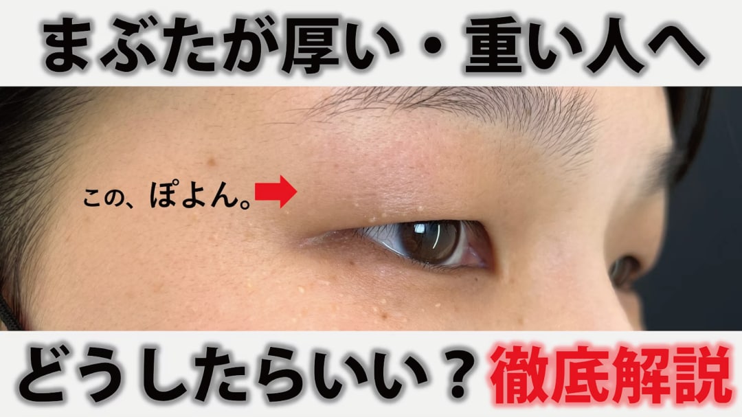 まぶたが重い・厚い原因を徹底解説!新宿本院 高川医師が教える切らない二重術と解消法