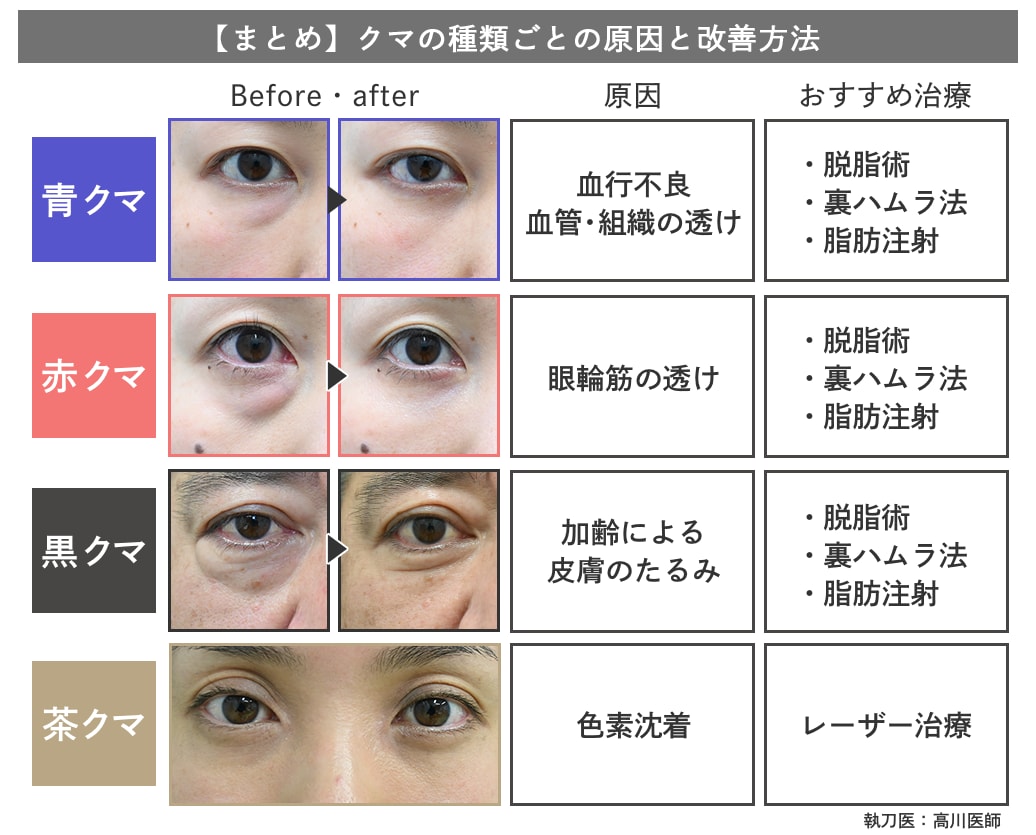 【種類別】原因・改善法まとめ<br />
