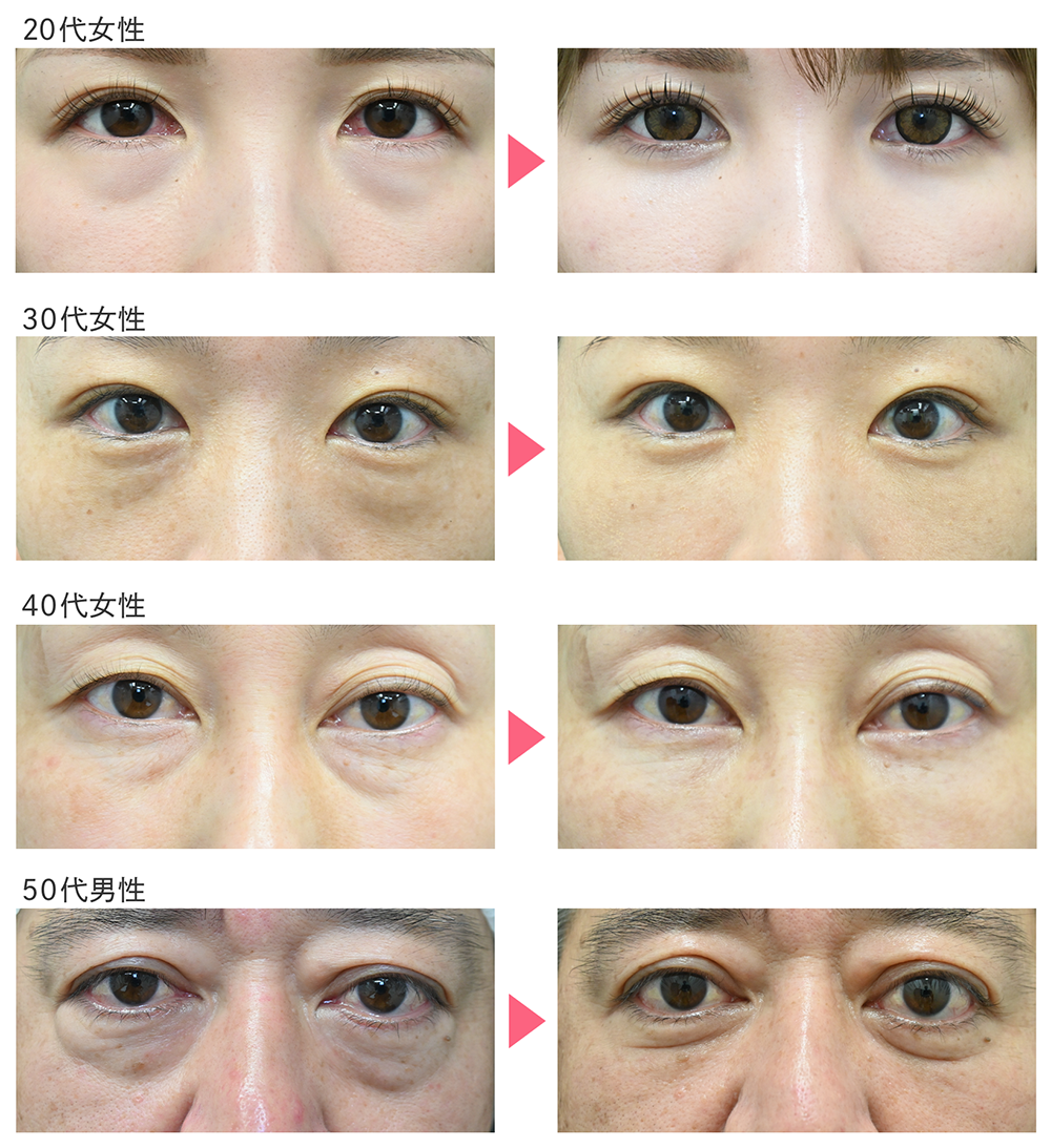 圧倒的な症例数から培った技術力が、美しい仕上がりに繋がっています。