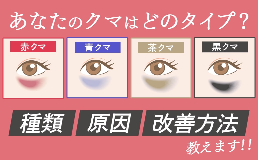 目の下のクマの種類・原因・改善方法を徹底解説!