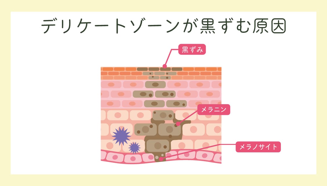 メラニン色素が過剰に生成
