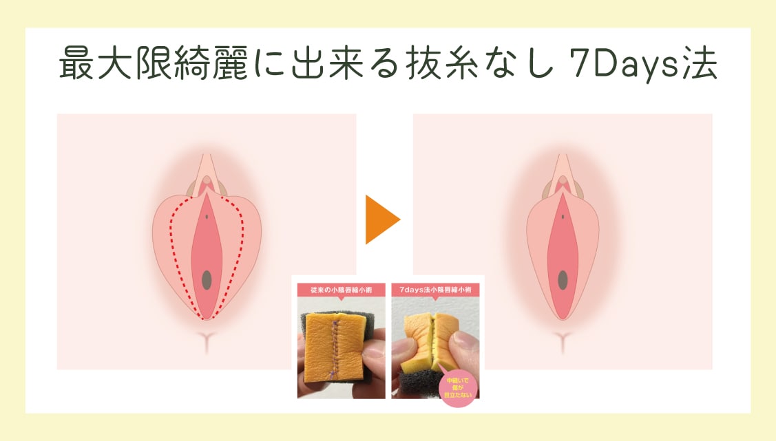 バレない綺麗な仕上がり・ダウンタイム最小限にしたいなら断然【抜糸なし7day法】