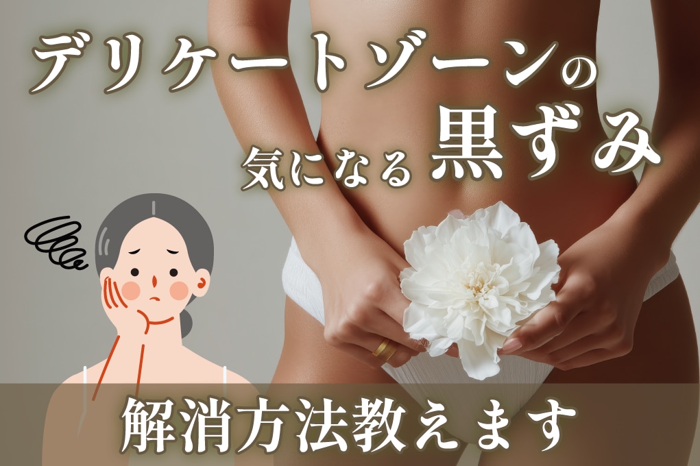 【VIO脱毛後気になってない？】デリケートゾーンの黒ずみ、解消方法教えます！レーザー治療全国No.1のSBC新宿本院・奥田綾乃医師が正しいケアもご紹介★