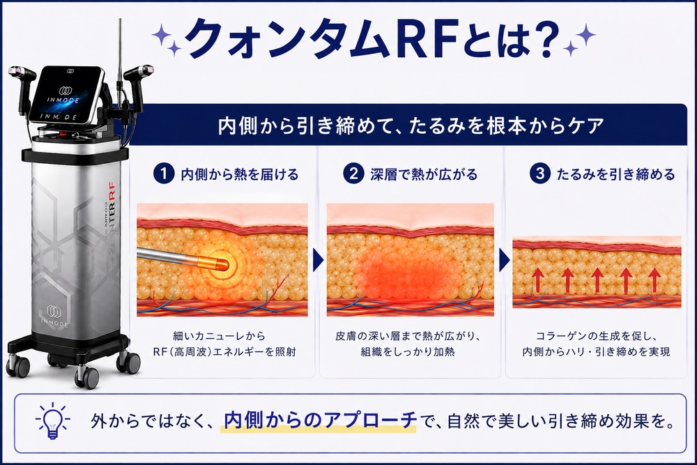 クォンタムRFとは？