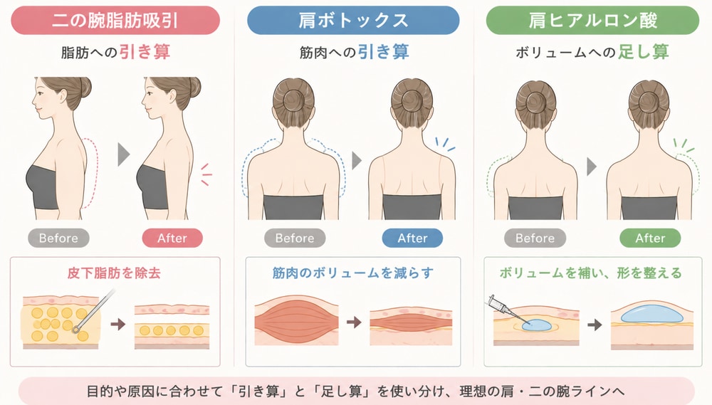 二の腕脂肪吸引