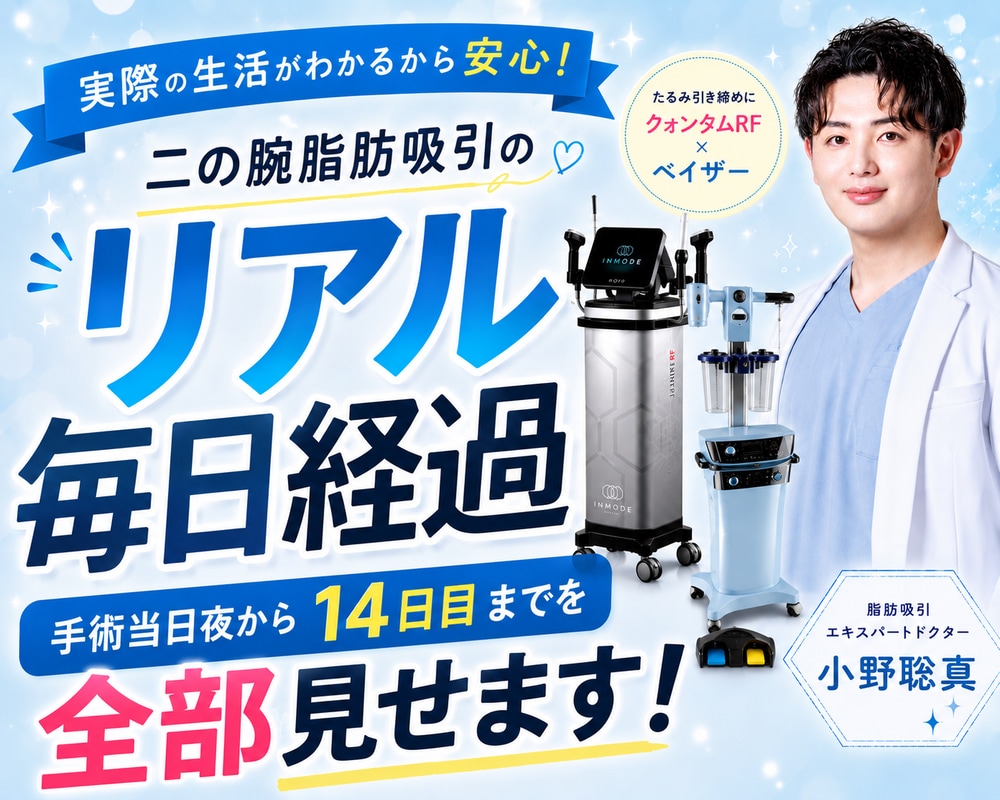 脂肪吸引エキスパートドクター小野聡真医師が行う二の腕脂肪吸引のダウンタイムは何日？仕事復帰・痛み・腫れを2名の毎日経過動画で紹介