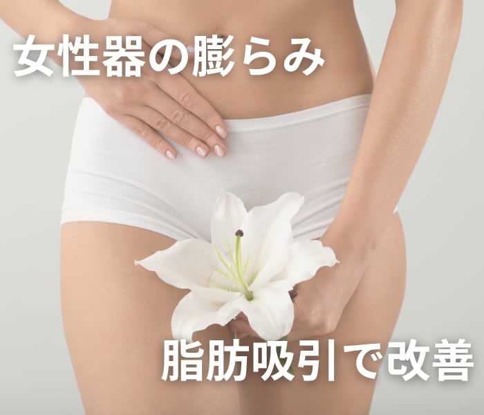 女性器がもっこり？誰にも聞けない「女性のどて脂肪吸引」を脂肪吸引エキスパートドクター小野聡真医師が解説
