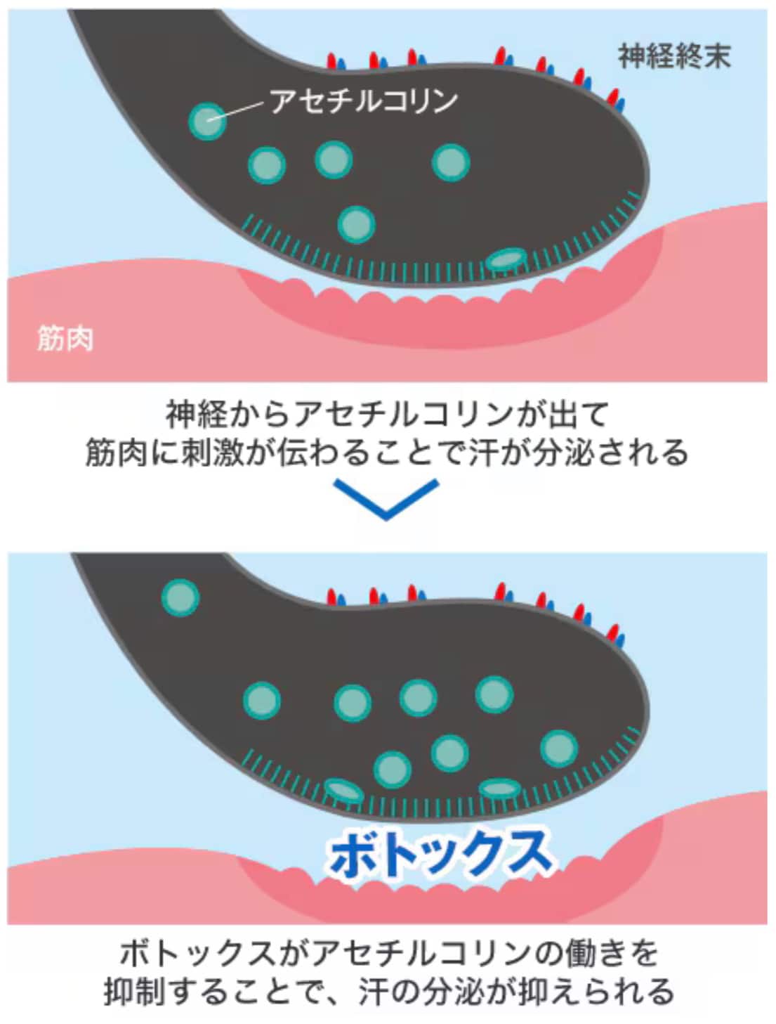 医師が解説するスソボトックスの基本メカニズム