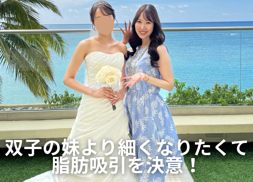 二の腕脂肪吸引で双子の妹より細く?30代女性スタッフの術後1ヶ月症例を脂肪吸引・名医 小野聡真医師が解説