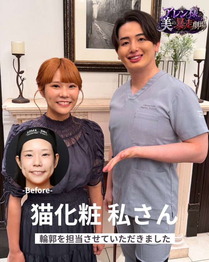 「面影をゼロにしたい⁉︎」猫化粧 私さんの輪郭整形|脂肪吸引エキスパートドクター小野聡真による元のかわいさを残す段階式アップデート