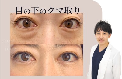 目元プロフェッショナルドクター 村上医師の若返り術