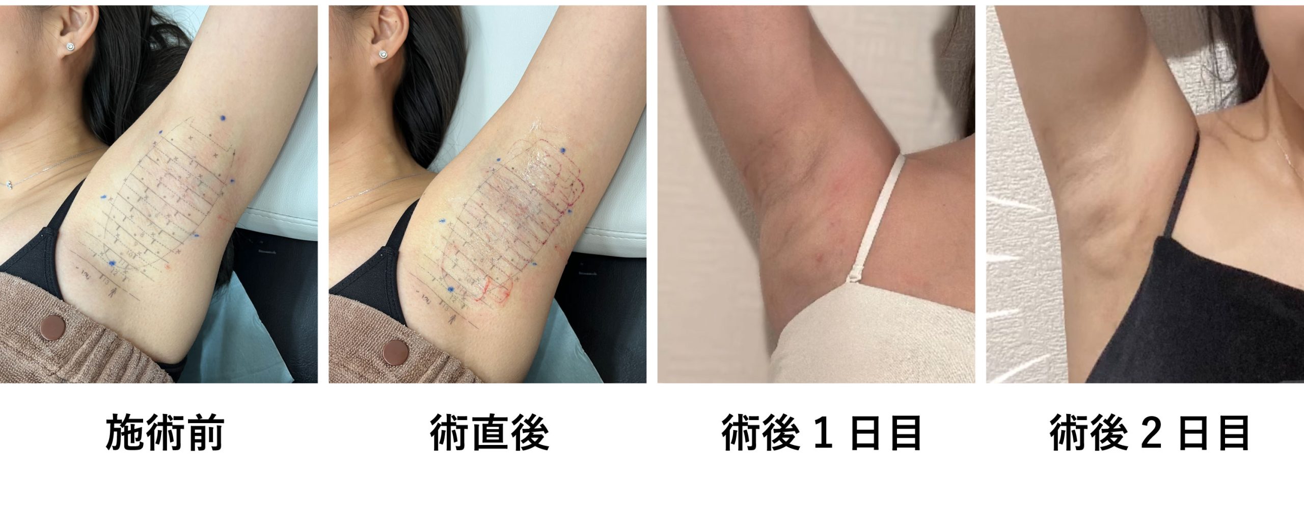 正直、ダウンタイムは?