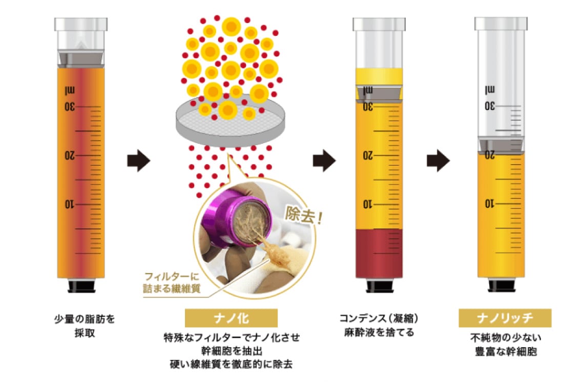 浅く細かいシワ：ナノリッチ