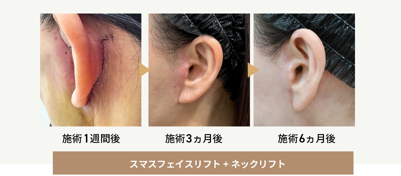 緻密な縫合技術で傷跡の心配軽減