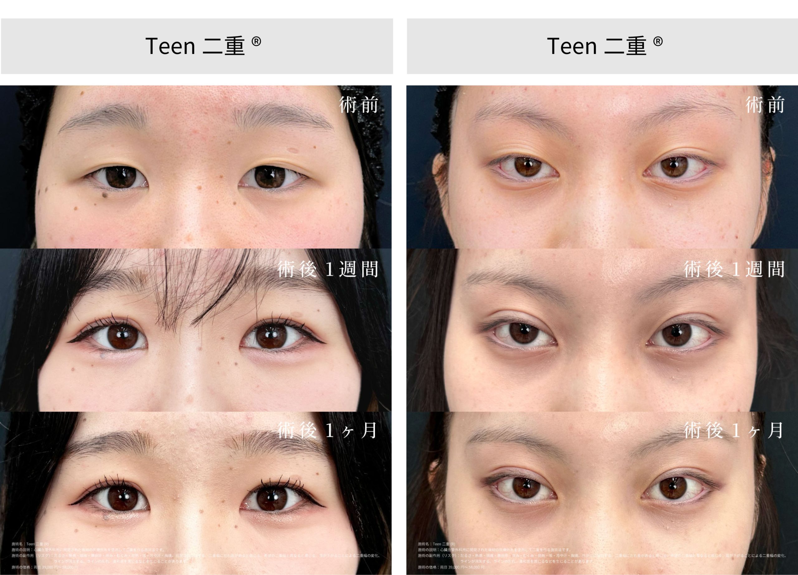 施術別で見る症例写真