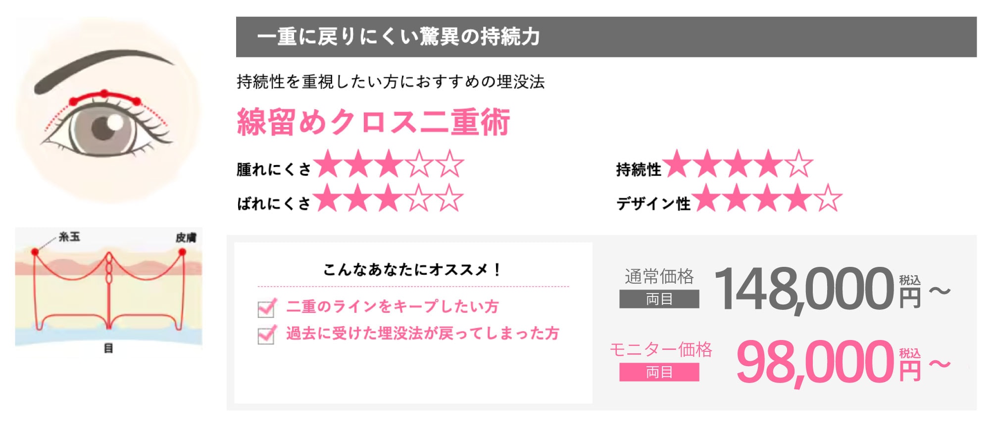 【持続性重視】線留めクロス二重術（旧フォーエバー二重術）