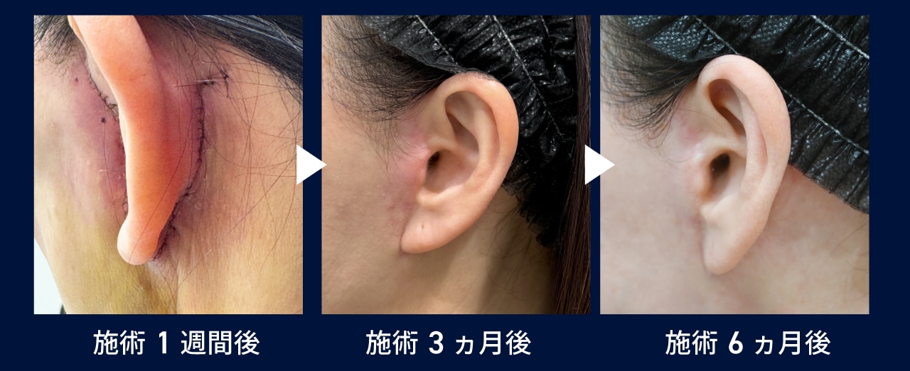 緻密な縫合技術で傷跡の心配軽減