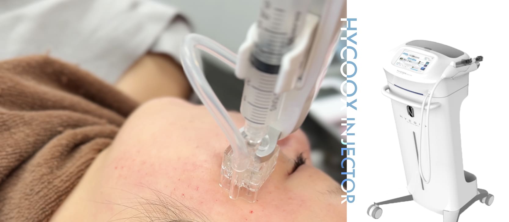 水光注射（ハイコックス）が人気の理由