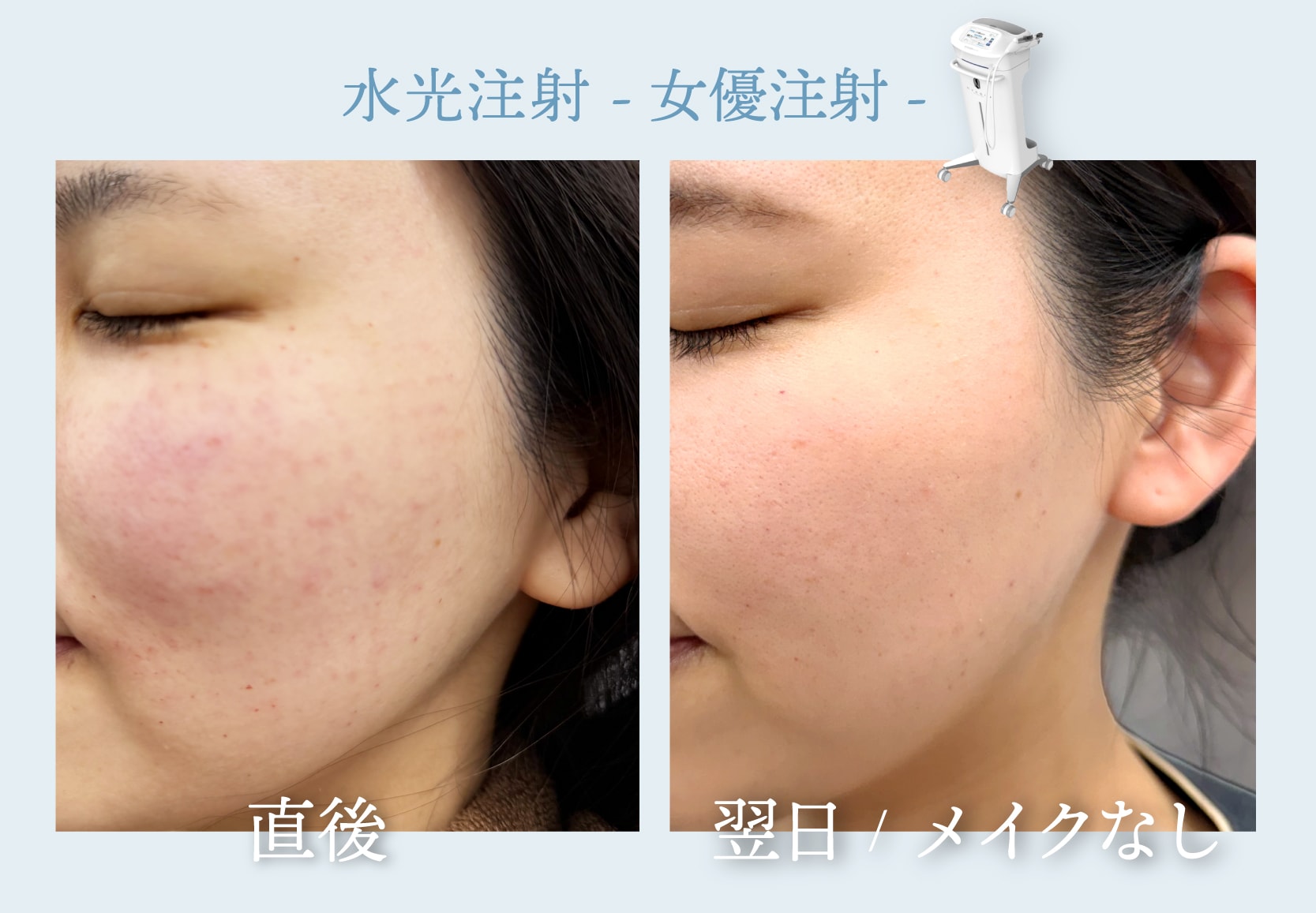 ダウンタイムはどれぐらい？